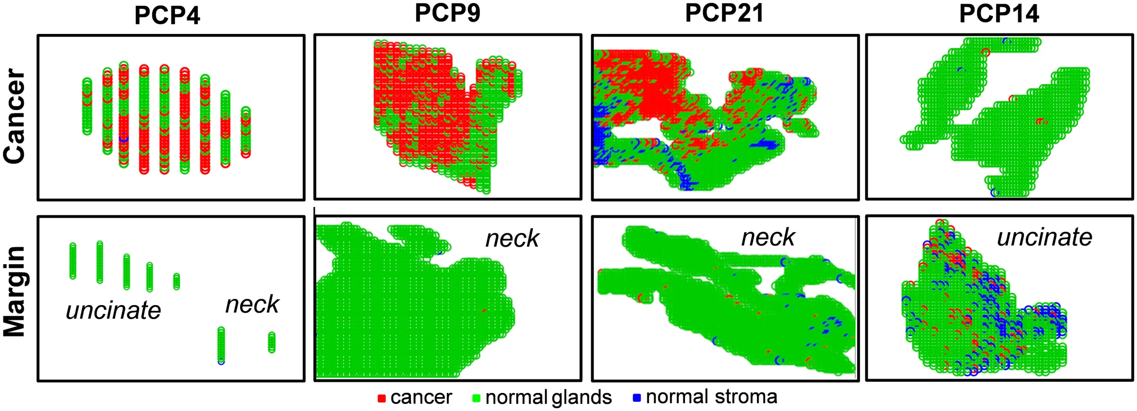 Lasso prediction results for cancer and margin tissues obtained prospectively from surgery in pancreatic cancer patients.