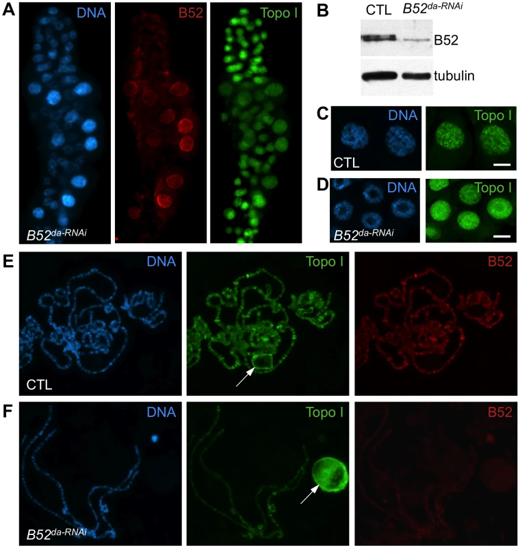 B52 depletion induces accumulation of Topo I in the nucleolus.