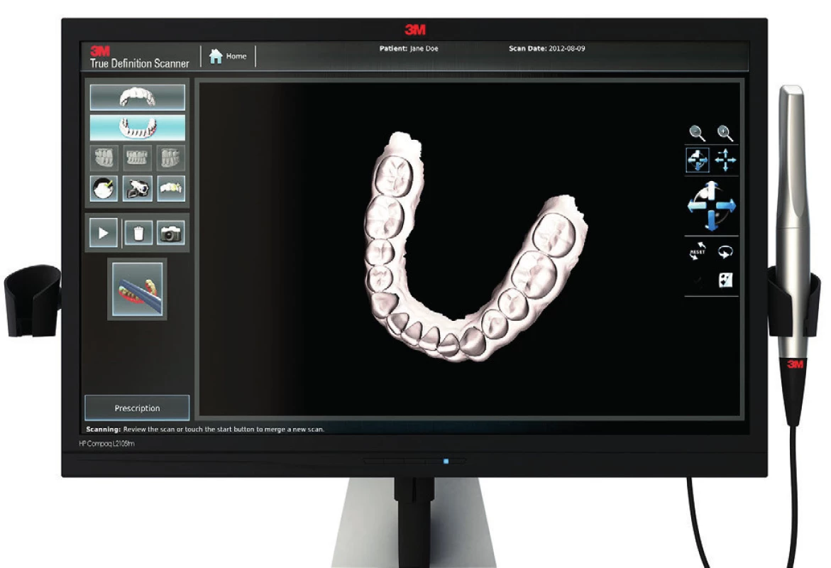 Intraorální skenovací systém True Definition, 3M ESPE (převzato z: <a href="http://www.dentalproductsreport.com/dental/article/how-chairside-scanning-3m-true-definition-scanner-can-help-you-better-practice-dentis">http://www.dentalproductsreport.com/dental/article/how-chairside-scanning-3m-true-definition-scanner-can-help-you-better-practice-dentis</a>)