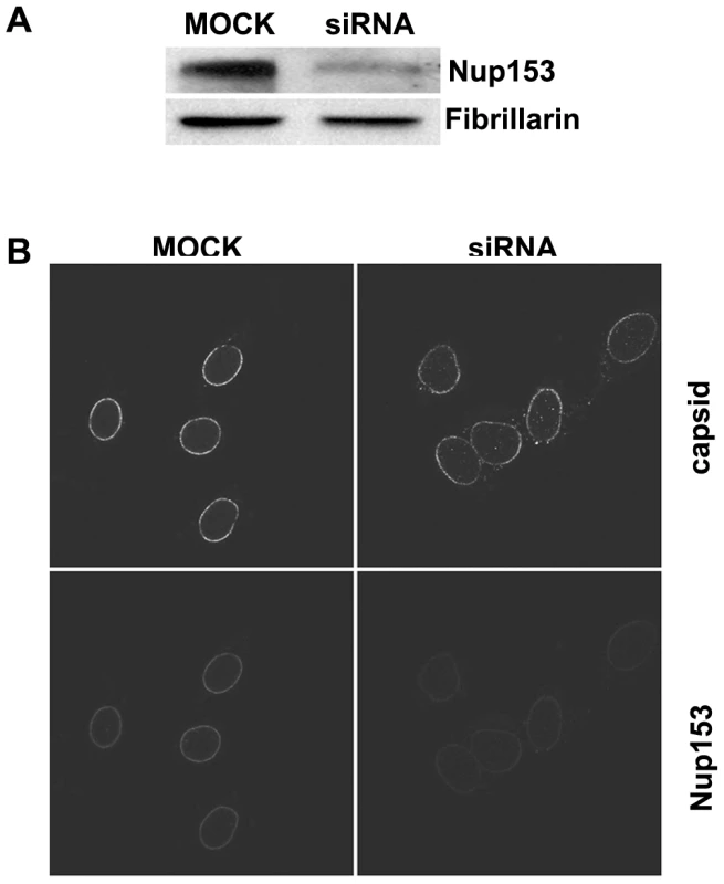 Nuclear import of P-rC in nuclei of partially Nup153-silenced cells.