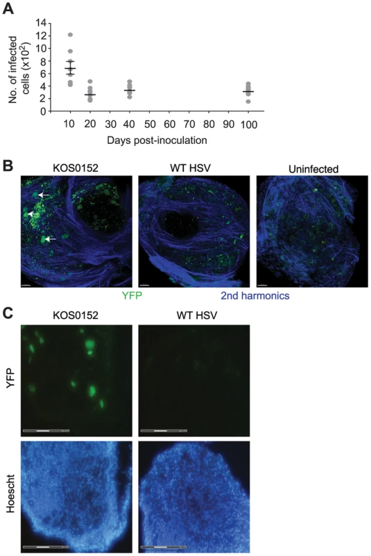 The number of infected cells remains stable during latency.