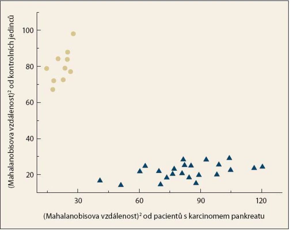 Grafické znázornění výsledku LDA pro kombinaci chiroptických metod (ECD, ROA) a konvenční Ramanovy spektroskopie v analýze krevní plazmy pacientů s karcinomem pankreatu (●) a kontrolních jedinců (▲).
Fig. 4. Graph representation of the LDA result for the combination of chiroptical methods (ECD, ROA) and conventional Raman spectroscopy in the analysis of blood plasma from patients with pancreatic cancer (●) and control subjects (▲).