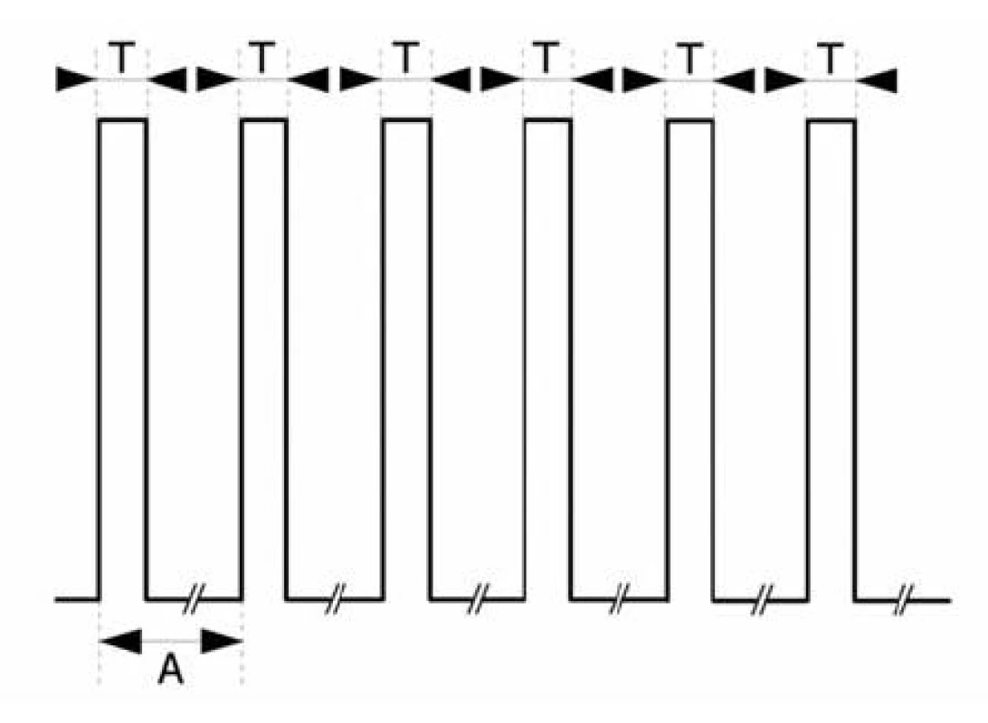 Tetanická stimulace
(T = 0,2 ms, A = 20 ms)