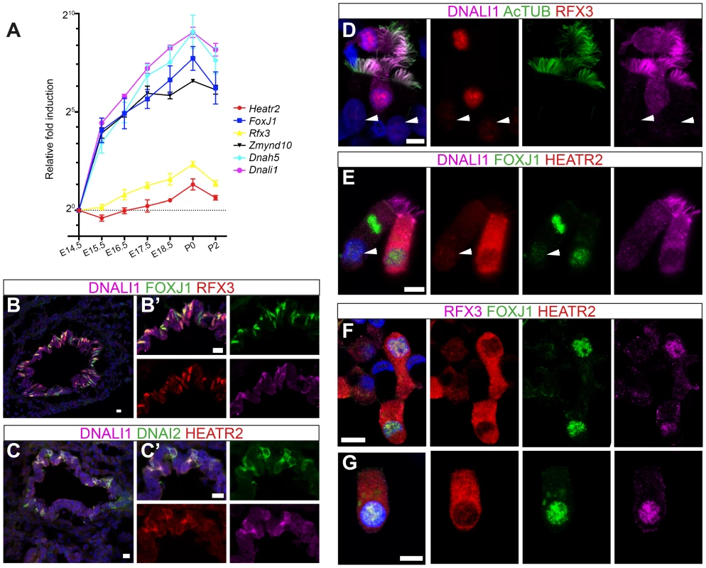 HEATR2 is highly expressed in tissues with motile cilia.