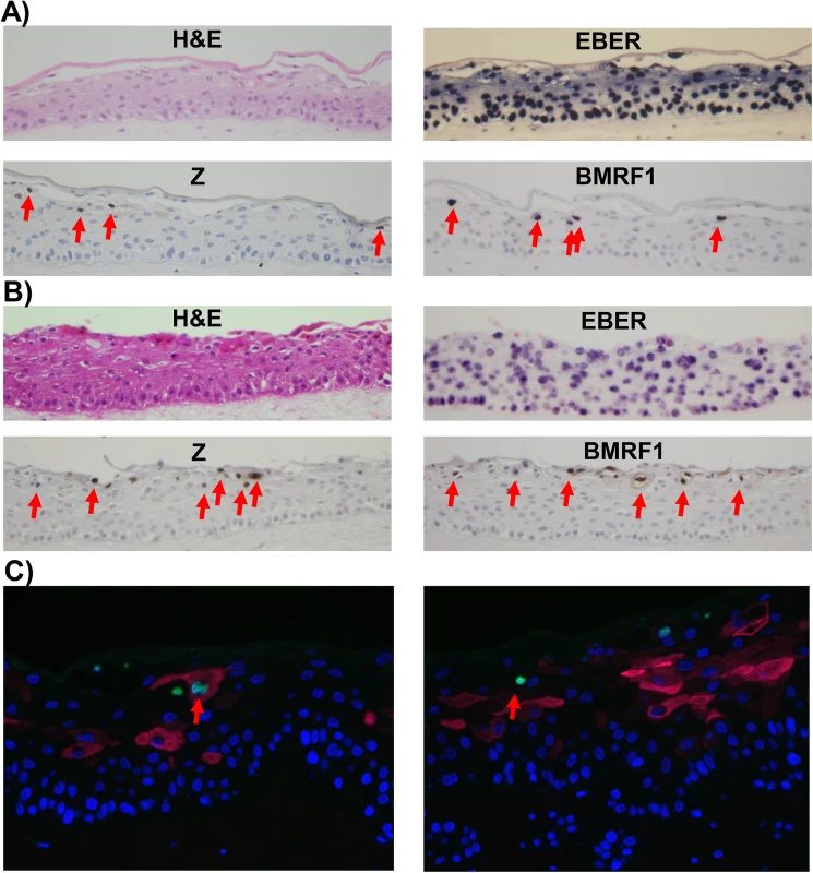 Lytic EBV protein expression in NOKs-Akata cells is restricted to the more differentiated cell layers.