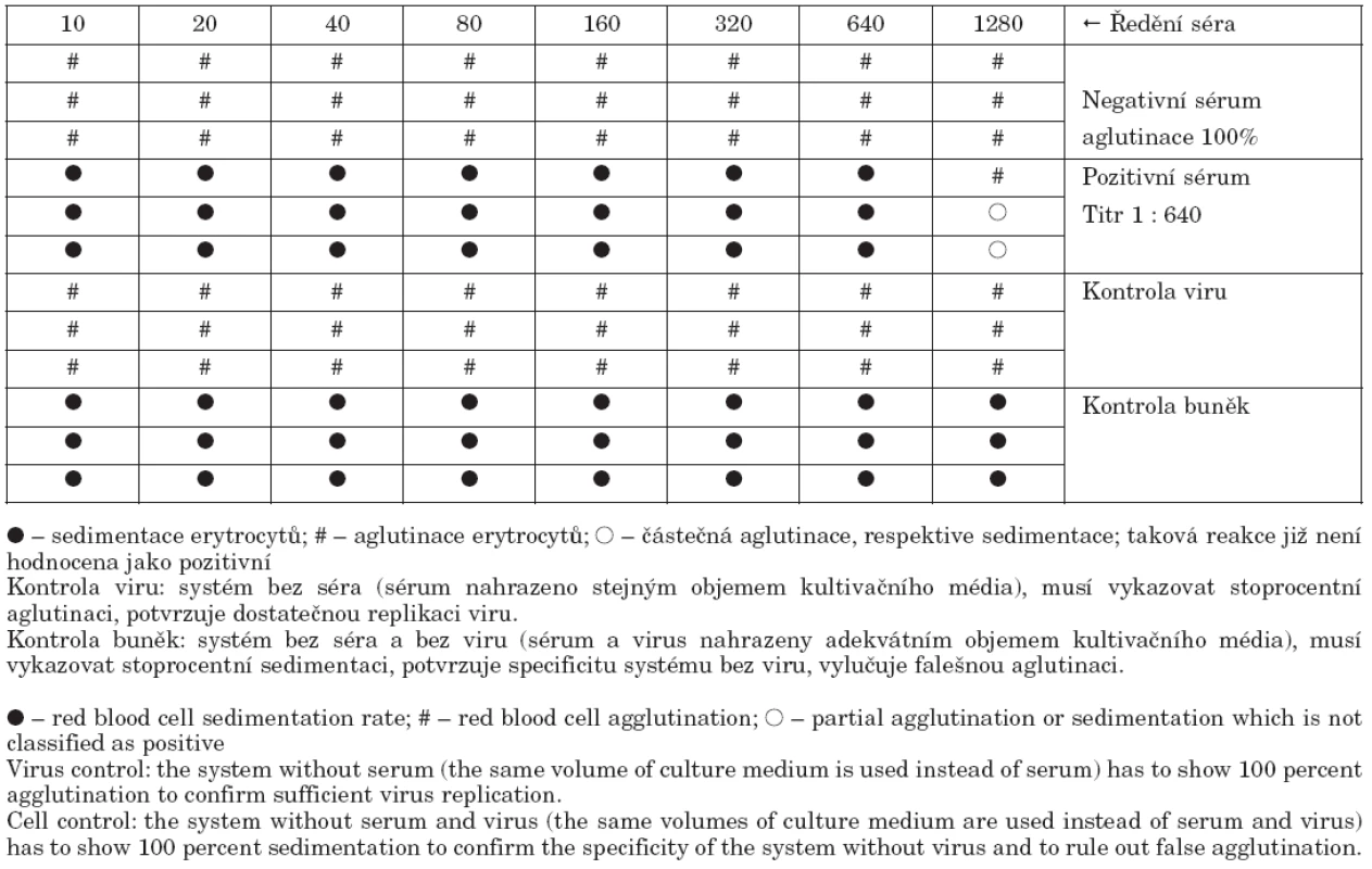 Vzor hodnocení mikroneutralizačního testu

Table 2. Example evaluation of microneutralization assay results