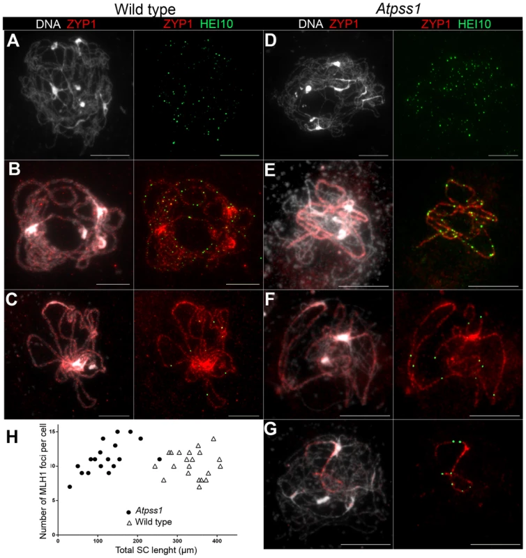 Co-immunolocalization of HEI10 and ZYP1.