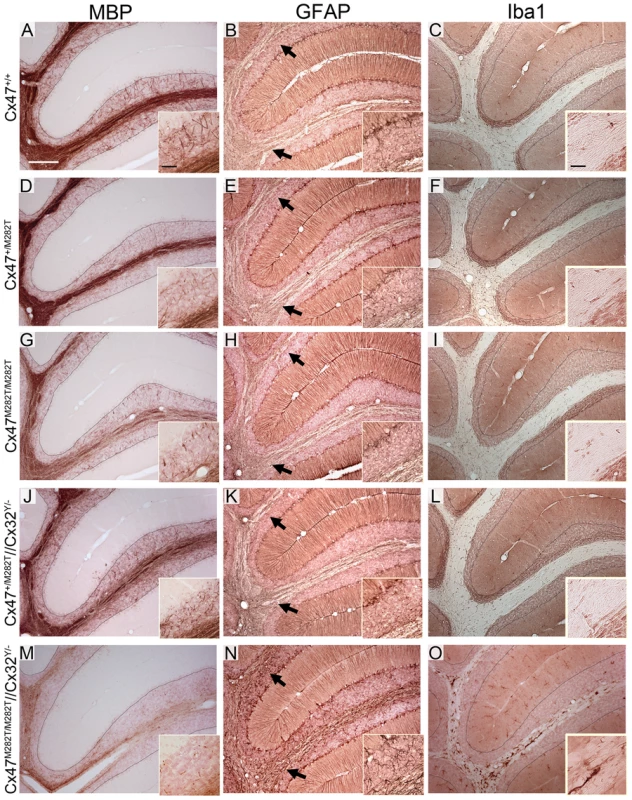 Insufficient myelination resulting from loss of Cx47 function is largely, although not completely, compensated in adult <i>Cx47<sup>+/M282T</sup></i> and <i>Cx47<sup>M282T/M282T</sup></i> mice.