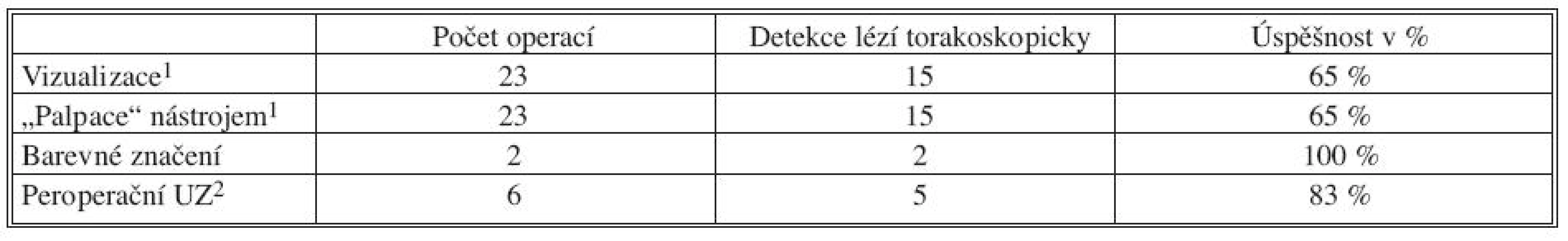 Torakoskopické operace pro plicní tumory (benigní, maligní primární a metastatické) v roce 2006–2009
Tab. 1. Thoracoscopic procedures for lung tumors (benign, malignant primary and metastatic) during 2006–2009