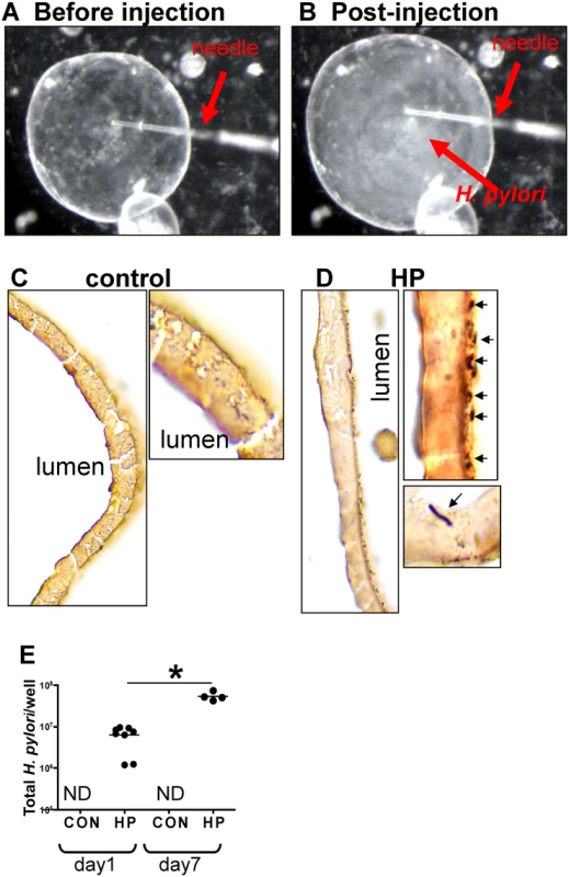 H. pylori microinjection and colonization of mFGOs.