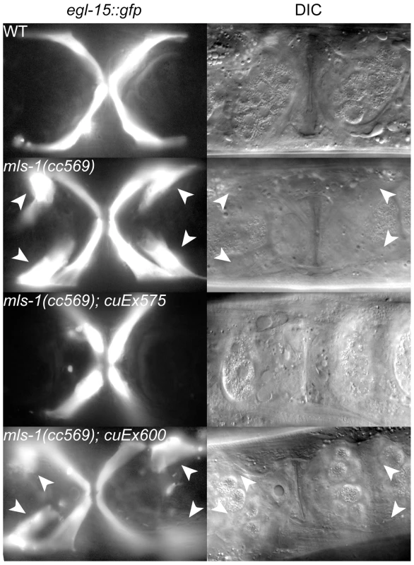 MLS-1 uterine muscle specification activity depends on its eh1 motif.