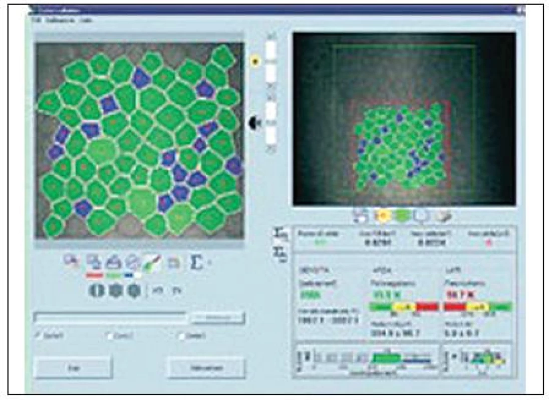 <i>(s povolením Nidek Technologies)</i>