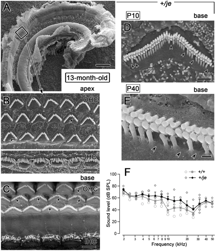 Minimal stereociliary defects, hair cell loss, and auditory brainstem response shifts in aged <i>+/je</i> mice.