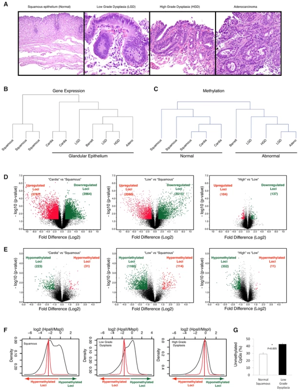 Global hypomethylation is seen early during esophageal carcinogenesis.