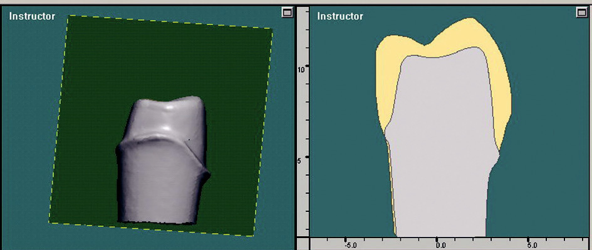 Promítnutí řezu ve 3D oddílu do oddílu 2D. Zde je patrné množství odbroušeného materiálu.