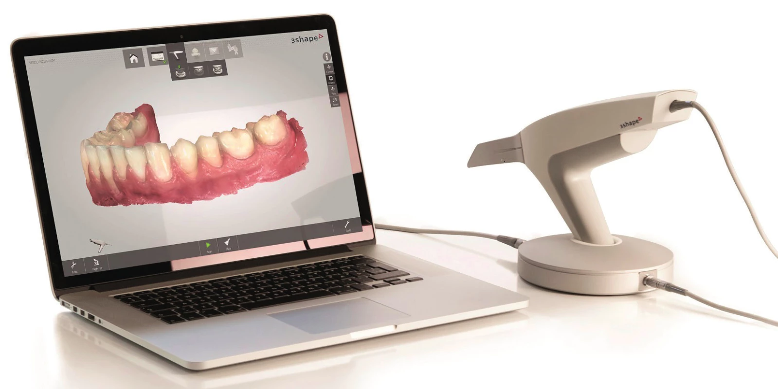 Ordinační skener TRIOS<sup>®</sup> (3Shape, Dánsko) pro přímou metodu digitalizace (převzato z: <a href=" http://heraeus-kulzer.com/int2/int/dentist/products_from_a_to_z/cara_16/cara_trios.aspx">http://heraeus-kulzer.com/int2/int/dentist/products_from_a_to_z/cara_16/cara_trios.aspx</a>)