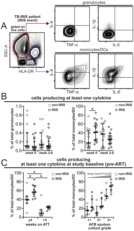 Increased frequency of monocytes spontaneously producing pro-inflammatory cytokines pre-ART in TB-IRIS patients.