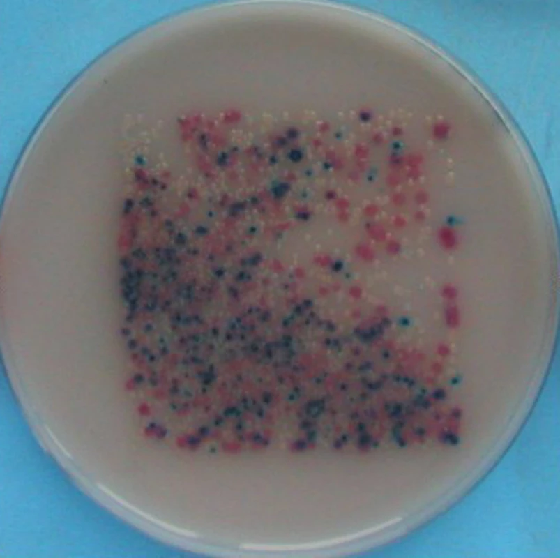 Kultivační nálezy na otisku, chromogenní půda Uri-Select 4
Tyrkysově modrá – Streptococcus agalactiae, počet kolonií 10–100 CFU/25 cm<sup>2</sup>, růžová – Escherichia coli, počet kolonií 10 000 CFU/25 cm<sup>2</sup>, tmavě modrá – Enterococcus faecalis, počet kolonií 100–1000 CFU/25 cm<sup>2</sup>, bezbarvá až průzračná – Pseudomonas aeruginosa, počet kolonií 10 000 CFU/25 cm<sup>2</sup>
Fig. 4: Results of microbial cultivation: chromogenic medium Uriselect 4 
Turquoise blue - Streptococcus agalactiae, number of colony 10–100 CFU/25 cm<sup>2</sup>, pink – Escherichia coli, number of colony 10 000 CFU/25 cm<sup>2</sup>, dark blue – Enterococcus faecalis, number of colony 100–1000 CFU/25 cm<sup>2</sup>, colourless, clear – Pseudomonas aeruginosa, number of colony 10 000 CFU/25 cm<sup>2</sup>