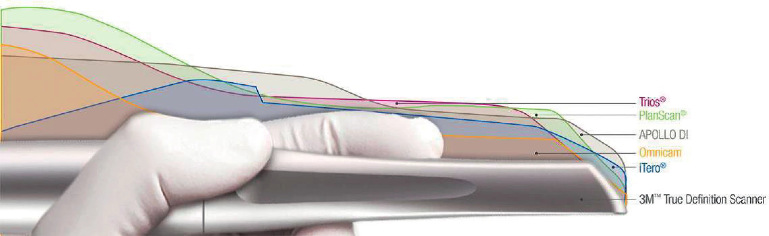 Srovnání skenovacích konzolí intraorálních skenerů (převzato z: <a href="http://solutions.3mcanada.ca/wps/portal/3M/en_CA/3M-ESPENA/
dental-professionals/products/category/digital-materials/true-definition-scanner/">http://solutions.3mcanada.ca/wps/portal/3M/en_CA/3M-ESPENA/
dental-professionals/products/category/digital-materials/true-definition-scanner/</a>).