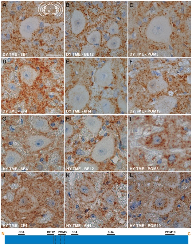 Strain specific differences in the clearance of PrP<sup>Sc</sup> in neurons of hamsters infected with either the DY or HY TME agents.