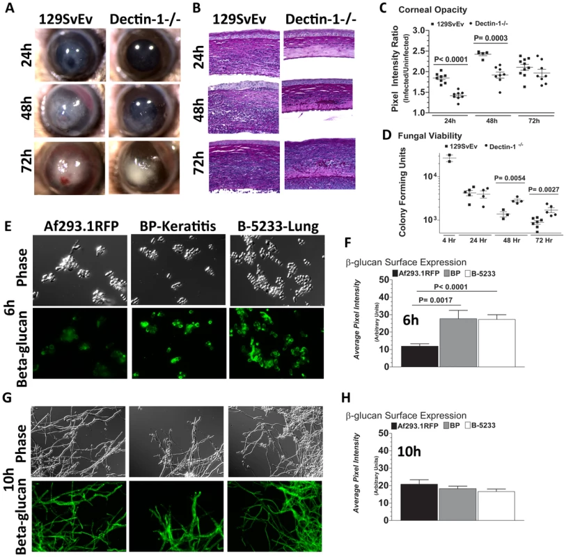 Role of Dectin-1 in keratitis caused by a clinical isolate of <i>A. fumigatus</i>.