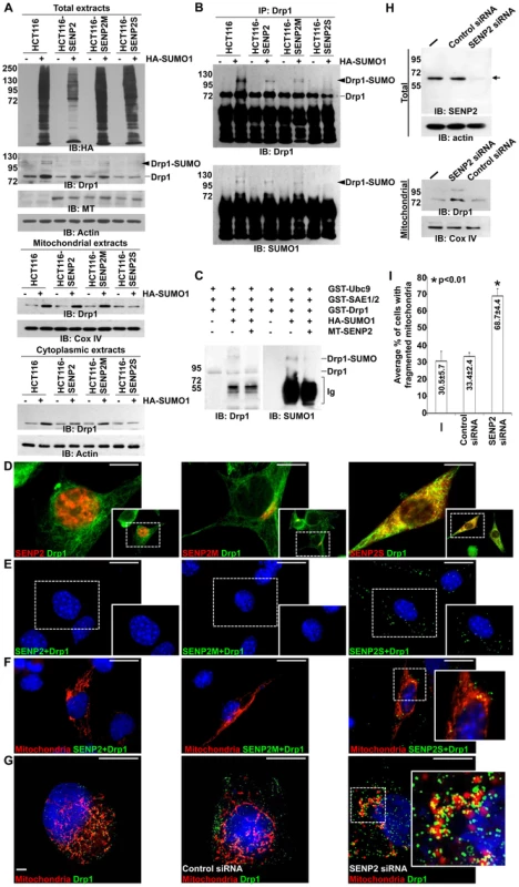 SUMO1 modification of Drp1 is regulated by SENP2.