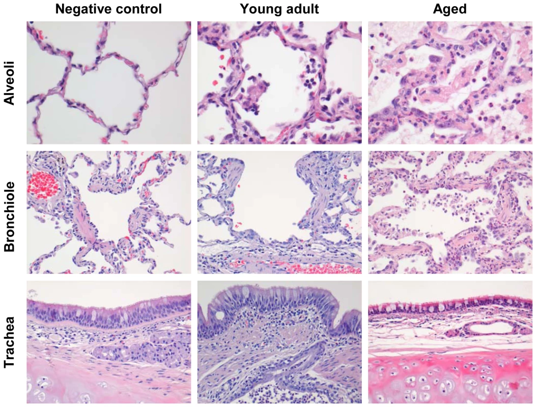 Histology of lungs from SARS-CoV-infected aged macaques.
