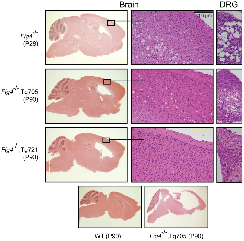 Spongiform degeneration of brain and DRG is rescued by the Fig4-I41T transgene.