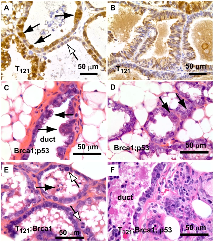 Early lesions in lactating mammary glands.