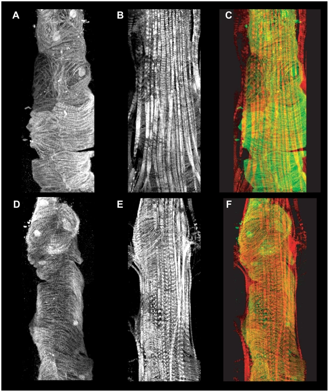 Evaluation of the A2 cardiac segment in homozygous <i>ru<sup>1</sup></i> mutants.