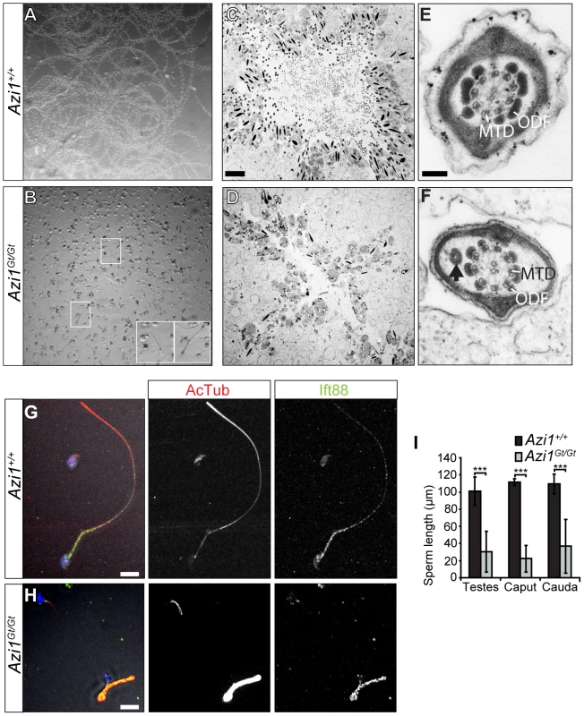Remaining <i>Azi1<sup>Gt/Gt</sup></i> sperm are immotile, with shortened flagella.