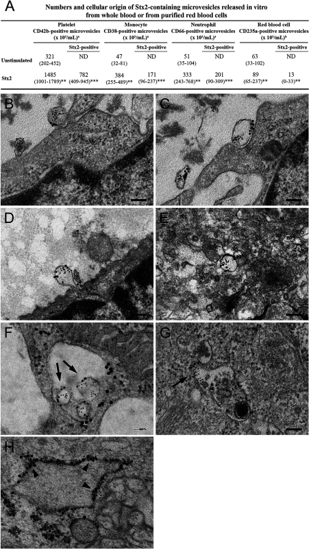 Blood cell-derived microvesicles transfer Stx2 to glomerular endothelial cells in vitro.
