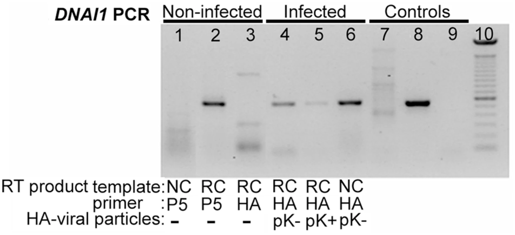 <i>HA</i>-tagged <i>DNAI1</i> gene transcription analysis by RT–PCR, in transduced normal HAECs.
