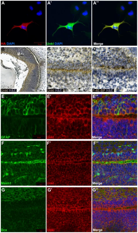 Unkl is expressed in the developing mammalian eye and SVZ.