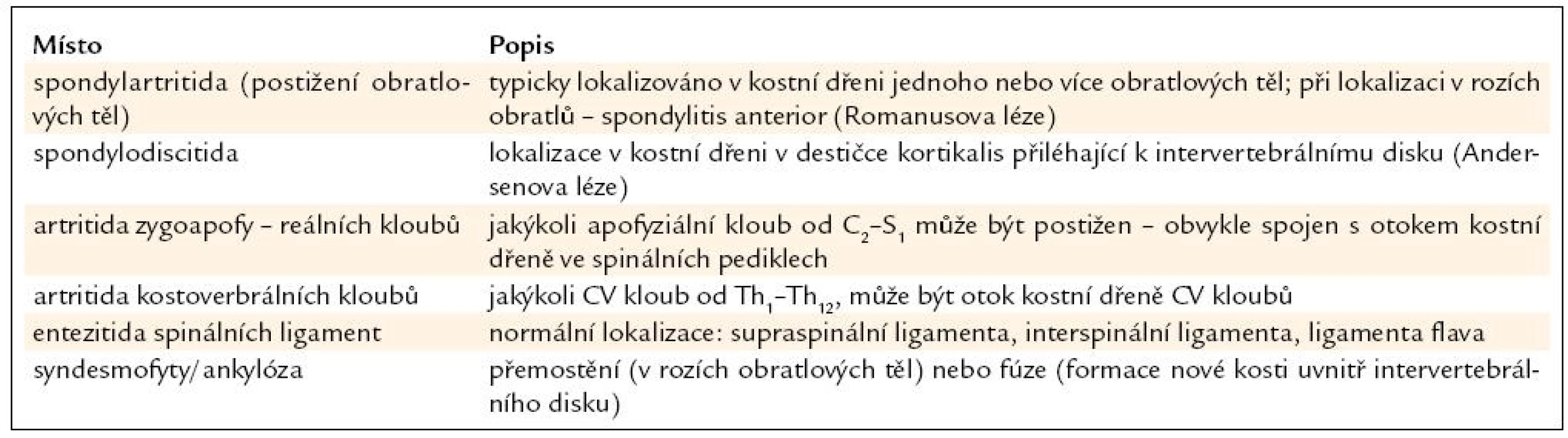 Typická místa aktivního zánětu u chronických změn na páteři u SpA.