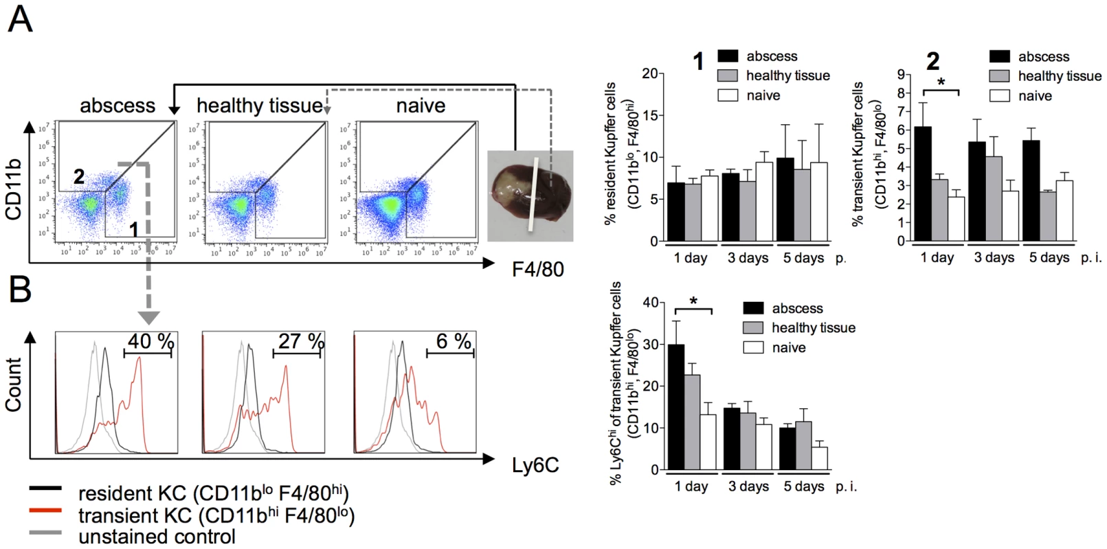 Characterization of Kupffer cell populations during ALA.