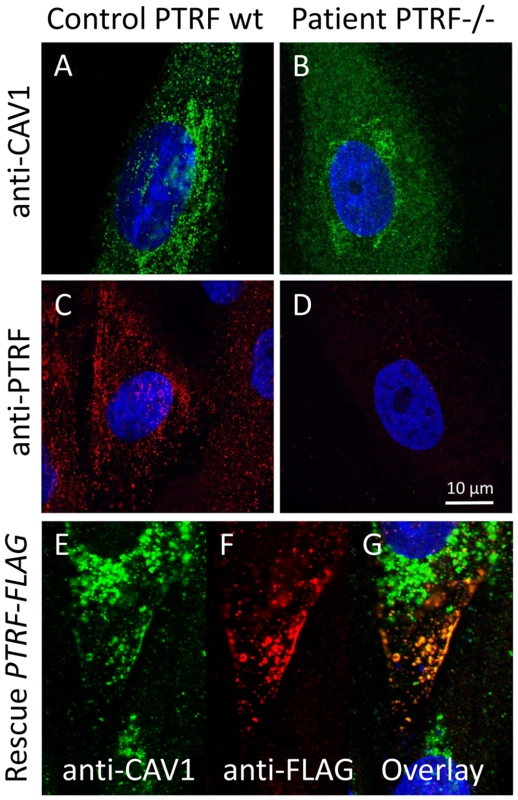 Cell-biological consequences of PTRF-CAVIN depletion.