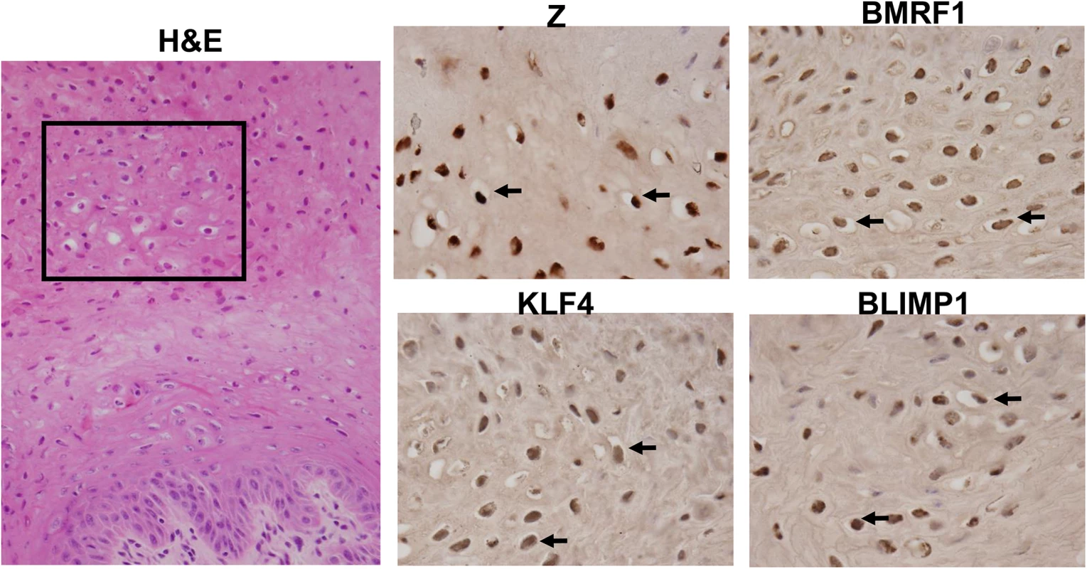 OHL cells express both KLF4 and BLIMP1.