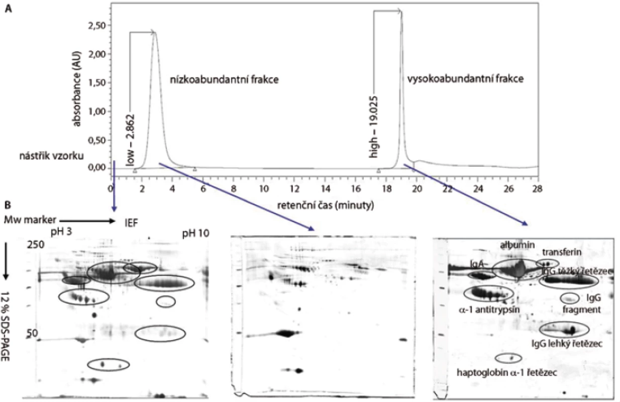 Multiple Afinity Removal System (MARS) – metoda pro odstranění 6 vysokoabundantních proteinů krevní plazmy. (A) Chromatografický záznam eluce jednotlivých frakcí. (B)  reprezentativní 2-DE gely proteinů plné krevní plazmy (45 μg), nízkoabundantní (100 μg) a vysokoabundantní (350 μg) frakce proteinů krevní plazmy.