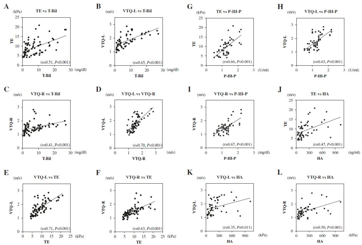 Correlations between T-Bil, Liver Elasticity, and Serum Markers of Liver Fibrosis. a TE and T-Bil (r = 0.51, P < 0.001), b VTQ-L and T-Bil (r = 0.65, <i>P</i> < 0.001), c VTQ-R and T-Bil (r = 0.41, <i>P</i> < 0.001), d VTQ-L and VTQ-R (r = 0.70, P < 0.001), e VTQ-L and TE (r = 0.71, P < 0.001), f VTQ-R and TE (r = 0.63, <i>P</i> < 0.001), g TE and P-III-P (r = 0.66, <i>P</i> < 0.001), h VTQ-L and P-III-P (r = 0.63, P < 0.001), i VTQ-R and P-III-P (r = 0.67, P < 0.001), j TE and HA (r = 0.47, P < 0.001), k VTQ-L and HA (r = 0.35, <i>P</i> < 0.001), l VTQ-R and HA (r = 0.50, P < 0.001)