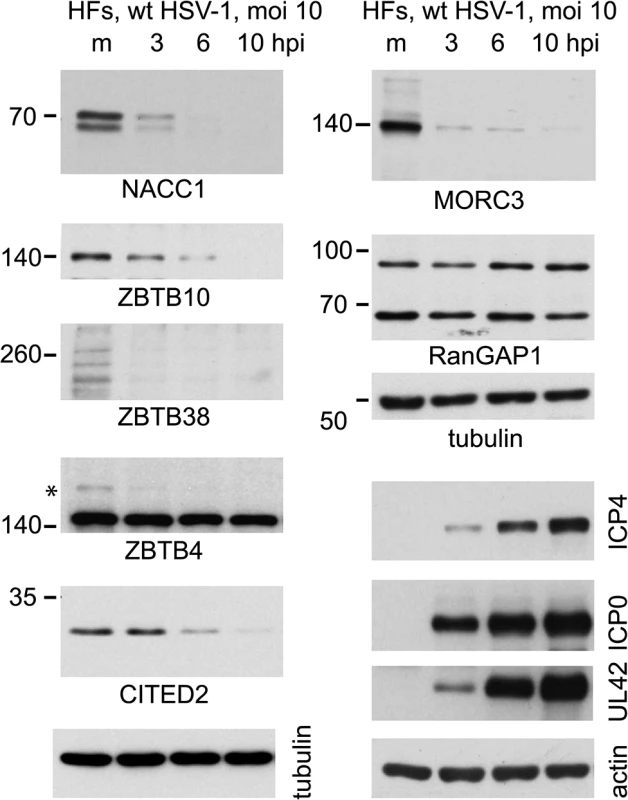 Time course of degradation of selected proteins of interest during wt HSV-1 infection.