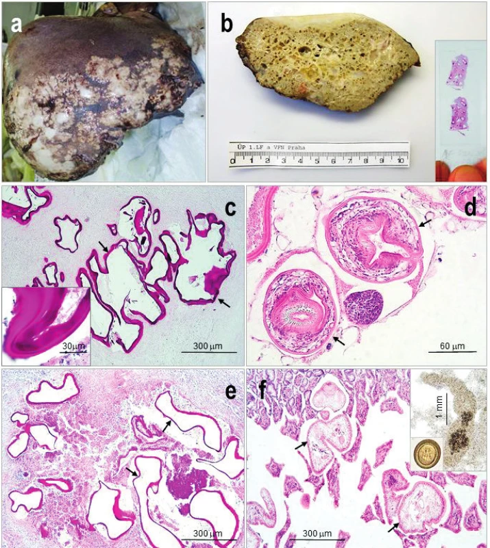 <i>Echinococcus multilocularis</i>
a) Pozdní stadium humánní alveolární echinokokózy v játrech s reparativními změnami a fibrózou.
b) Průřez alveokokem z jater fixovaných ve formolu ukazuje na „houbovitou“ strukturu parazita; ve výřezu histologický preparát alveokoka, na němž je již makroskopicky viditelná PAS pozitivní laminární membrána.
c–f) Histologický obraz:
c) nejčastěji prokazovaný sterilní alveokok v játrech člověka – germinativní vrstvu obklopuje bezbuněčná laminární membrána (šipky; detail ve výřezu), intenzivně se barvící PAS;
d) vzácně detekovaný fertilní alveokok s protoskolexy (šipky), opatřené přísavkami a háčky, (H&amp;E);
e) metacestoda v jaterní tkáni prasete divokého, (PAS), se shodným obrazem jako c);
f) dospělých tasemnic (šipky) v tenkém střevě kočky s viditelnými přísavkami a háčky, (H&amp;E), ve výřezu dospělá tasemnice a vajíčko (vel. 30–36 x 25–30 μm).
Snímek a) laskavě zapůjčila MUDr. V. Žampachová, I. patologicko-anatomický ústav, FNUSA a MU v Brně.
Figure 2. <i>Echinococcus multilocularis</i>
a) Late phase of human alveolar echinococcosis in the liver with fibrosis and reparative changes;
b) Cross section through the parasitic „spongiform“ lesion, in detail a histological mount with macroscopically visible laminated membrane, (PAS);
c–f) Histological picture of:
c) sterile parasitic vesicles with strongly PAS stained laminated membrane (arrows; detail) are mostly detected;
d) fertile parasites with protoscoleces (arrows) are scarcely detected, (H&amp;E);
e) sterile metacestode in the liver of wild board, (PAS), the same pictitres as in c;
f) adult cestodes in the cat small intestine; in details adult cestode and egg (size 30–36 x 25–30 μm). 
Figure a) Courtesy of V. Žampachová, First department of Pathological Anatomy Masaryk University and St. Anne&amp;s Faculty Hospital in Brno.