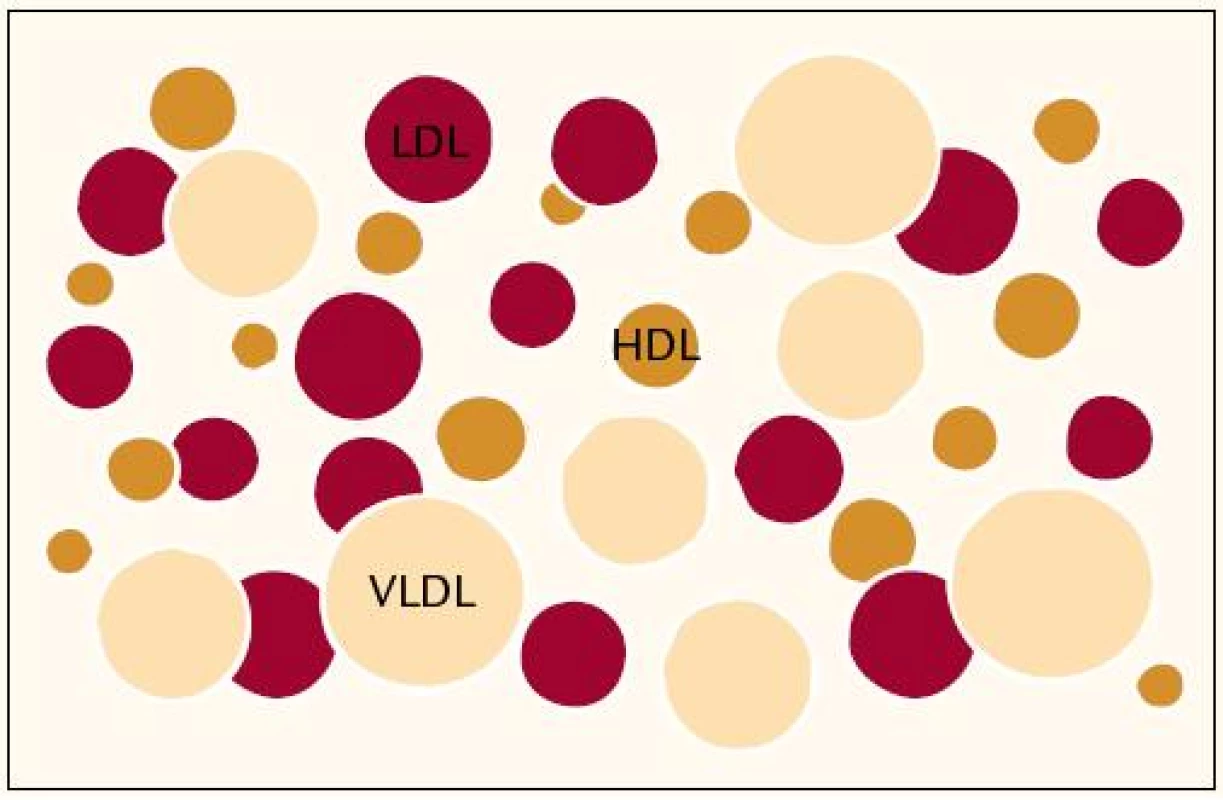Lipoproteinový profil plazmy – heterogenní rodiny lipoproteinů nesou různý aterogenní potenciál.
