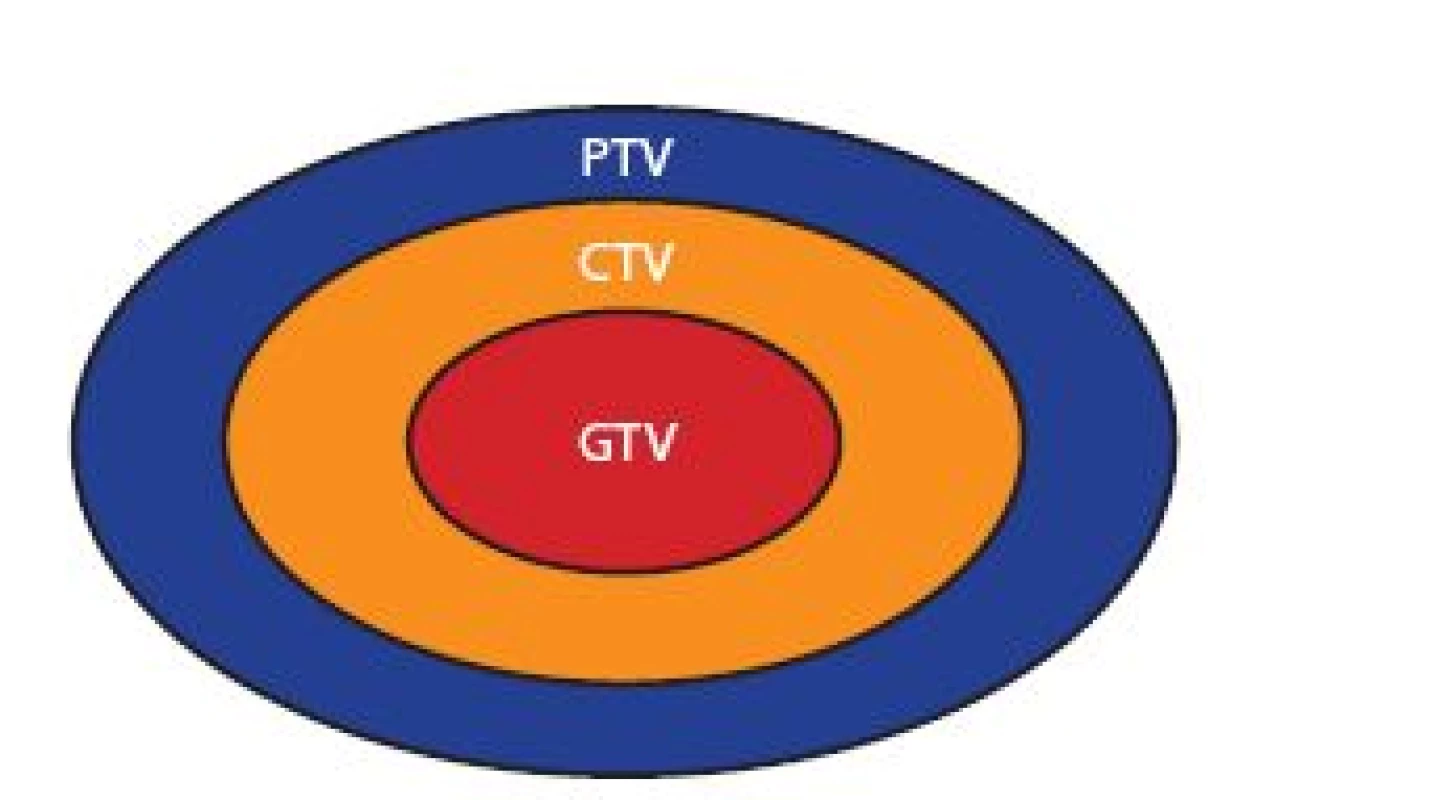 Cílové objemy v radioterapii
Fig. 1 Target volumes for radiation therapy