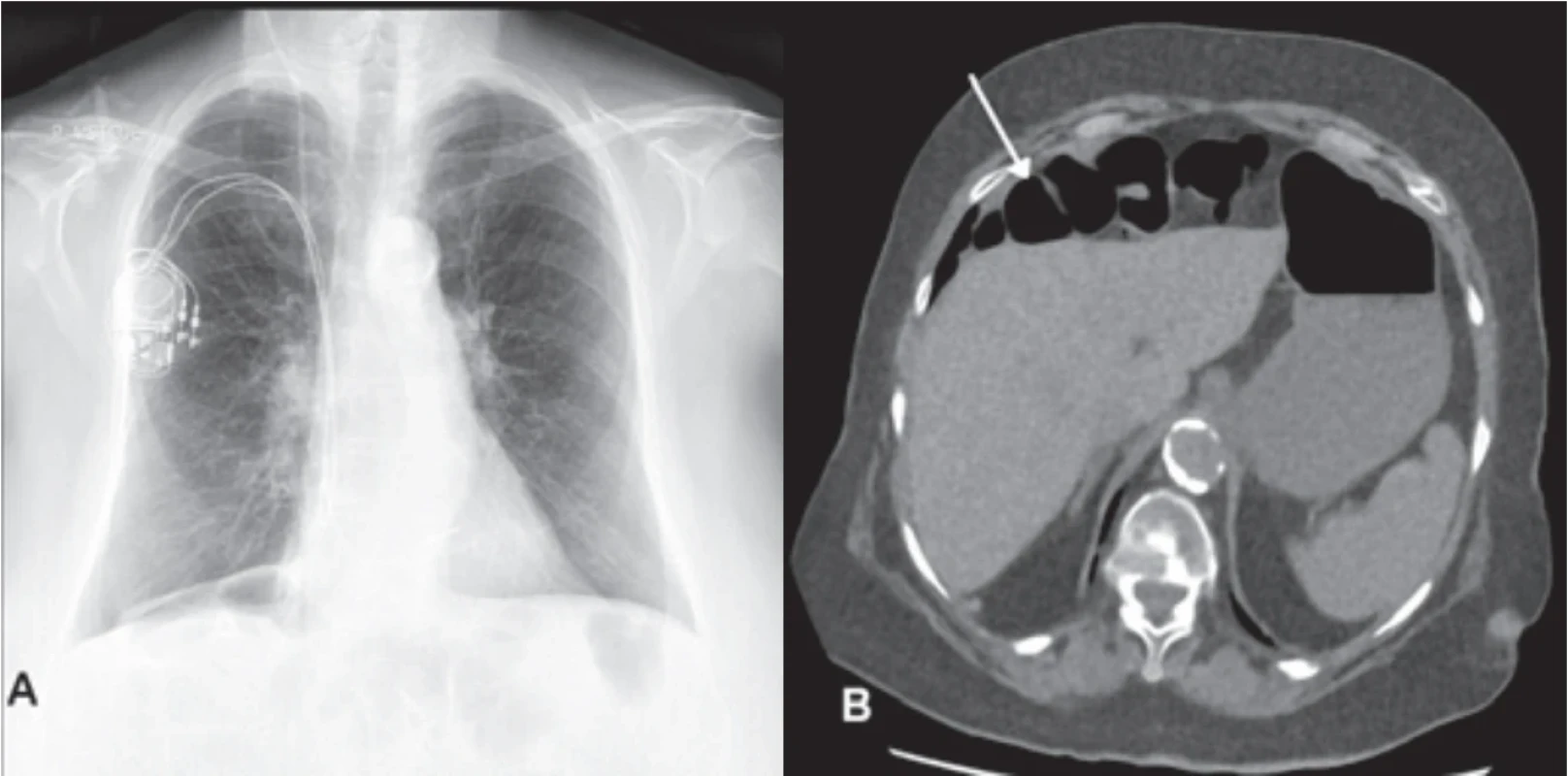  / Fig. 3.