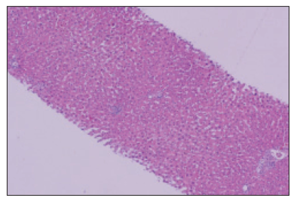 Histologický obraz pečene – prehľadný snímok.