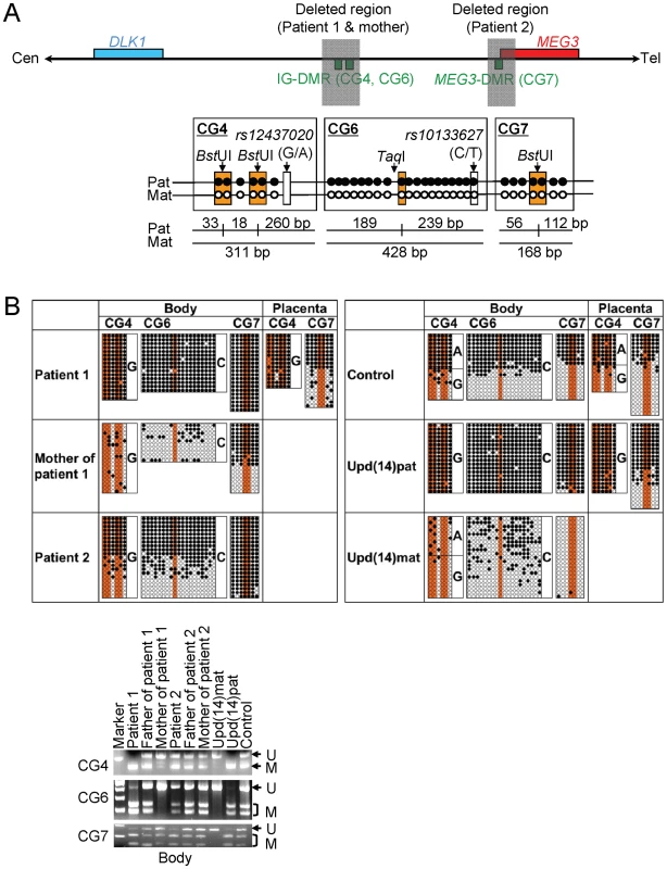 Methylation analysis of the IG-DMR (CG4 and CG6) and the <i>MEG3</i>-DMR (CG7).