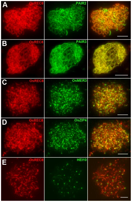 Immunolocalization of several meiotic elements in the <i>Oshus1-1</i> mutant.