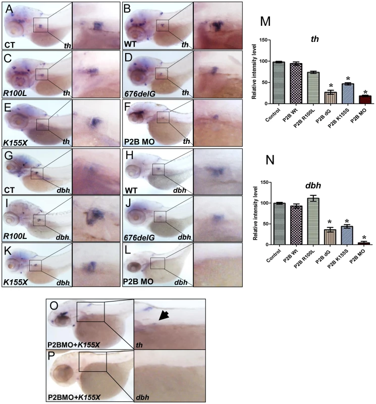 The neuroblastoma-associated <i>676delG</i> and <i>K155X PHOX2B</i> variants cause decreased terminal differentiation in the SCG.