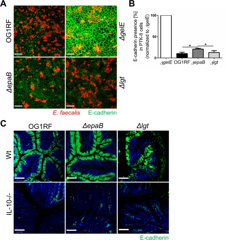 Gelatinase E activity of <i>E</i>. <i>faecalis</i> is not dependent on <i>epaB</i> or <i>lgt</i>.